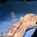 4b2a5859-bf43-46db-831c-2f23142a74cb otwarta ręka z modelami 3D